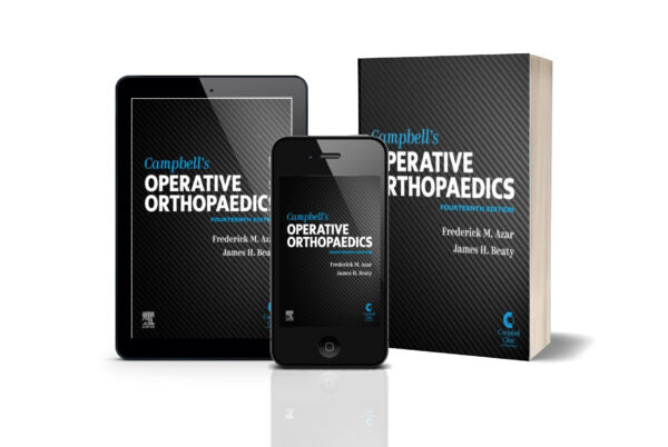 Campbell's Operative Orthopaedics, 4-Volume Set 14th Edition