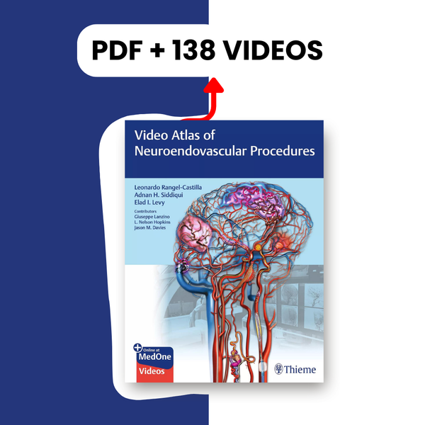 Video Atlas of Neuroendovascular Procedures (PDF + 138 VIDEOS )